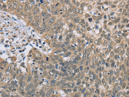 DACH2 Polyclonal Antibody Store at -20°C - MSE Supplies LLC