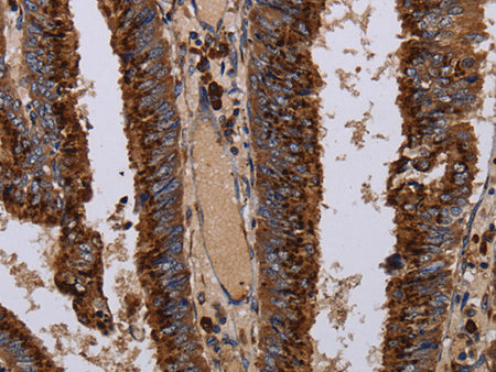 PPP1R1B Polyclonal Antibody Store at -20°C - MSE Supplies LLC
