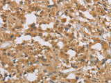 DIO1 Polyclonal Antibody Store at -20°C - MSE Supplies LLC