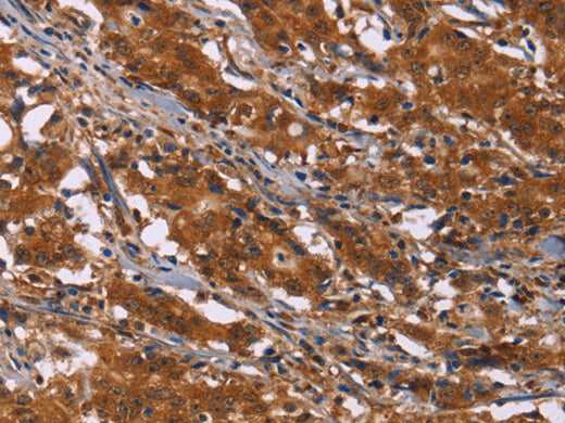 DCBLD2 Polyclonal Antibody Store at -20°C - MSE Supplies LLC