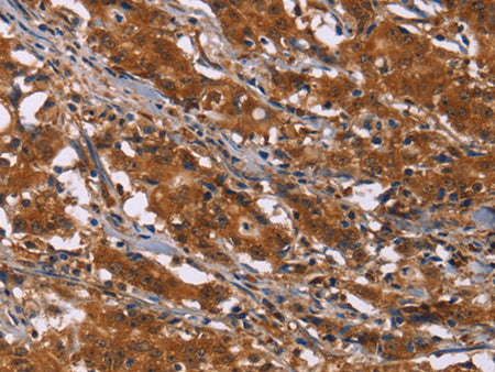DCBLD2 Polyclonal Antibody Store at -20°C - MSE Supplies LLC