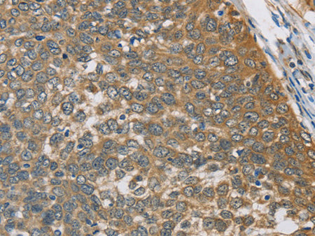 TNFRSF10D Polyclonal Antibody Store at -20°C - MSE Supplies LLC
