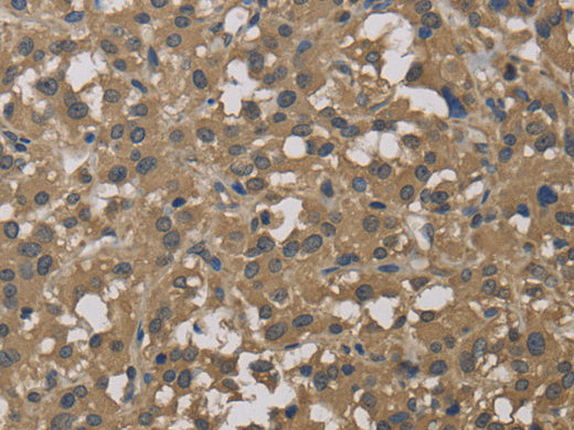 DCTN3 Polyclonal Antibody Store at -20°C - MSE Supplies LLC