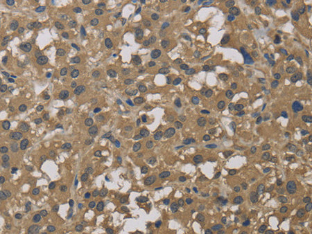 DCTN3 Polyclonal Antibody Store at -20°C - MSE Supplies LLC