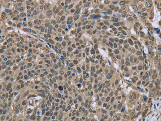 DCTN4 Polyclonal Antibody Store at -20°C - MSE Supplies LLC