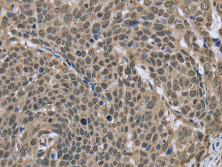 DCTN4 Polyclonal Antibody Store at -20°C - MSE Supplies LLC