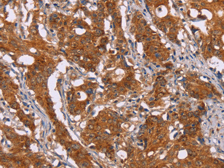 DCTN6 Polyclonal Antibody Store at -20°C - MSE Supplies LLC