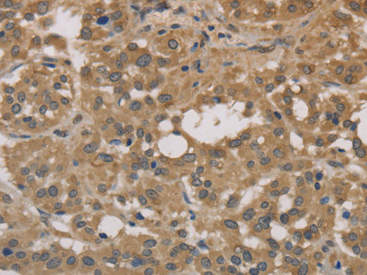 DEGS1 Polyclonal Antibody Store at -20°C - MSE Supplies LLC
