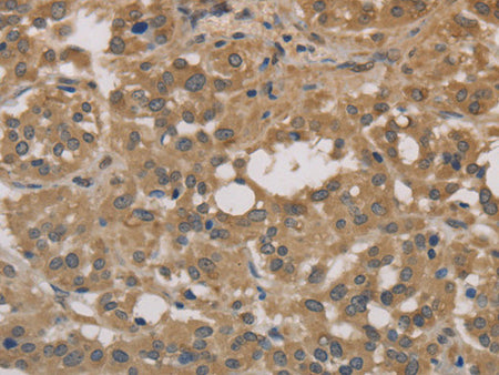 DEGS1 Polyclonal Antibody Store at -20°C - MSE Supplies LLC