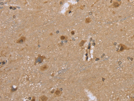 DLD Polyclonal Antibody Store at -20°C - MSE Supplies LLC