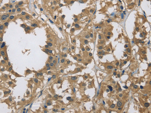 DSG2 Polyclonal Antibody Store at -20°C - MSE Supplies LLC