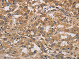 DSTN Polyclonal Antibody Store at -20°C - MSE Supplies LLC