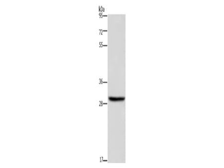 DHRS3 Polyclonal Antibody Store at -20°C - MSE Supplies LLC