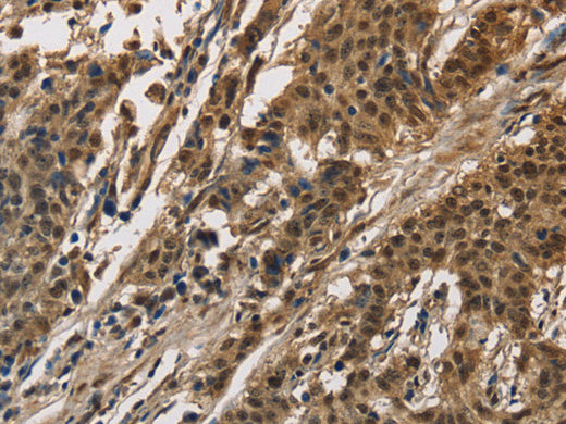 CCAR1 Polyclonal Antibody Store at -20°C - MSE Supplies LLC