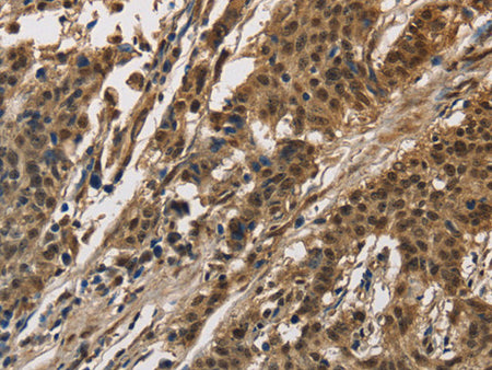 CCAR1 Polyclonal Antibody Store at -20°C - MSE Supplies LLC