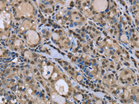 DYNLL1 Polyclonal Antibody Store at -20°C - MSE Supplies LLC