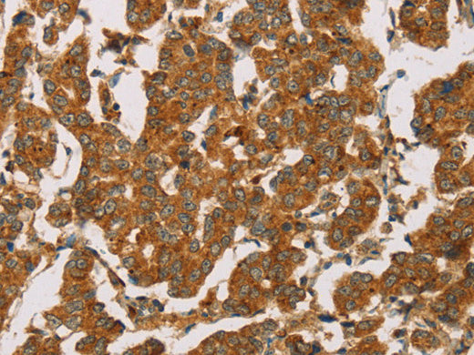 DLL4 Polyclonal Antibody Store at -20°C - MSE Supplies LLC