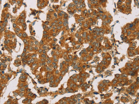 DLL4 Polyclonal Antibody Store at -20°C - MSE Supplies LLC