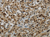 DNA Ligase1 Polyclonal Antibody Store at -20°C - MSE Supplies LLC