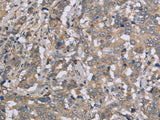 DTNB Polyclonal Antibody Store at -20°C - MSE Supplies LLC