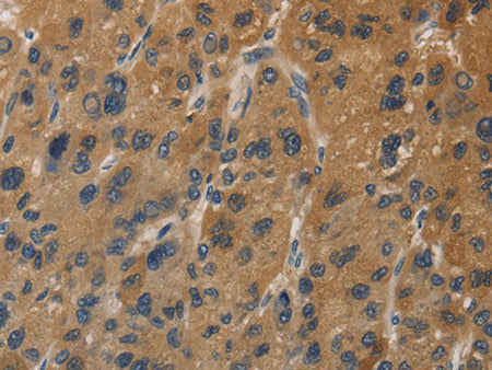 DUSP23 Polyclonal Antibody Store at -20°C - MSE Supplies LLC
