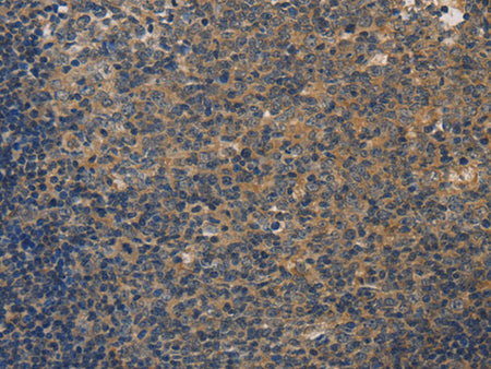 DUSP26 Polyclonal Antibody Store at -20°C - MSE Supplies LLC