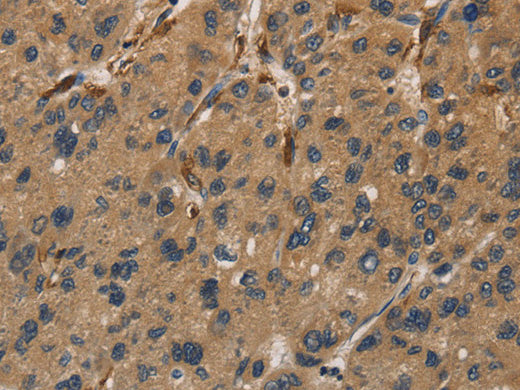 UBE2S Polyclonal Antibody Store at -20°C - MSE Supplies LLC
