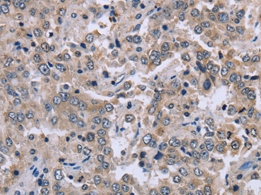 EID1 Polyclonal Antibody Store at -20°C - MSE Supplies LLC