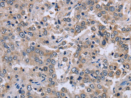 EID1 Polyclonal Antibody Store at -20°C - MSE Supplies LLC
