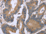 KIAA1324 Polyclonal Antibody Store at -20°C - MSE Supplies LLC