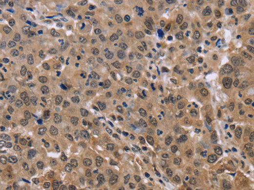 KIF25 Polyclonal Antibody Store at -20°C - MSE Supplies LLC