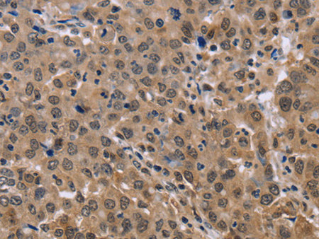 KIF25 Polyclonal Antibody Store at -20°C - MSE Supplies LLC