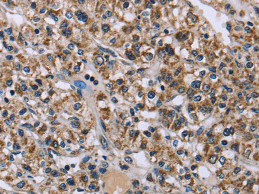 KCNJ11 Polyclonal Antibody Store at -20°C - MSE Supplies LLC