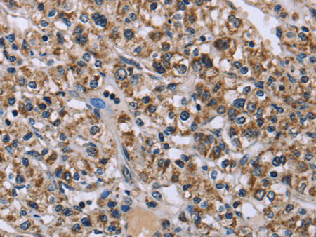KCNJ11 Polyclonal Antibody Store at -20°C - MSE Supplies LLC