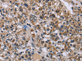 KCNJ11 Polyclonal Antibody Store at -20°C - MSE Supplies LLC