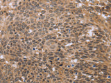 ERCC6L Polyclonal Antibody Store at -20°C - MSE Supplies LLC