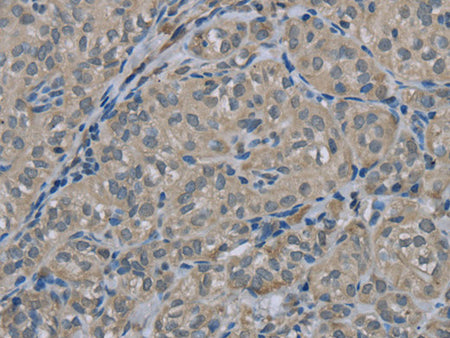 EDN1 Polyclonal Antibody Store at -20°C - MSE Supplies LLC