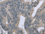 BMX Polyclonal Antibody Store at -20°C - MSE Supplies LLC