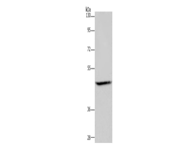 ETS2 Polyclonal Antibody Store at -20°C - MSE Supplies LLC