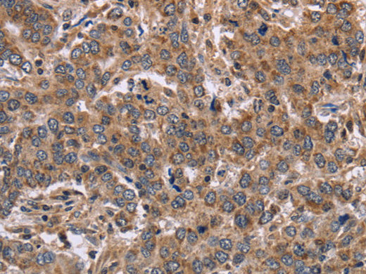 FAAH2 Polyclonal Antibody Store at -20°C - MSE Supplies LLC