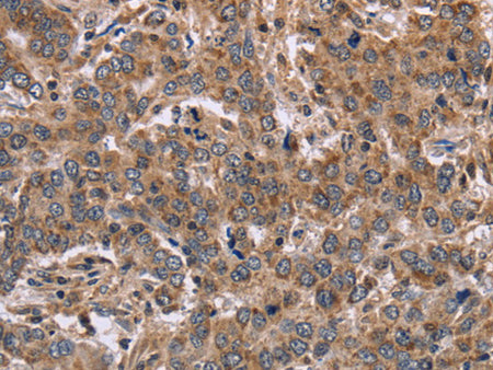 FAAH2 Polyclonal Antibody Store at -20°C - MSE Supplies LLC
