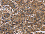 FABP6 Polyclonal Antibody Store at -20°C - MSE Supplies LLC