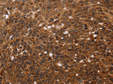 FANCF Polyclonal Antibody Store at -20°C - MSE Supplies LLC