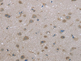 FAP Polyclonal Antibody Store at -20°C - MSE Supplies LLC