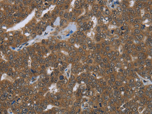 FASTKD1 Polyclonal Antibody Store at -20°C - MSE Supplies LLC