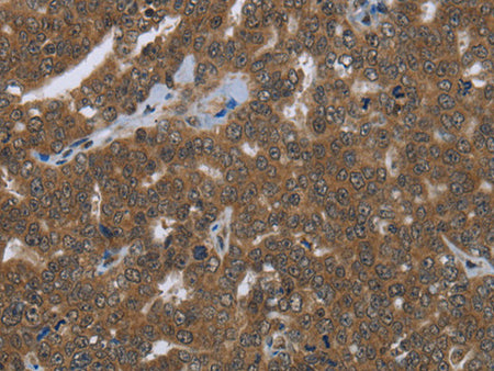 FASTKD1 Polyclonal Antibody Store at -20°C - MSE Supplies LLC