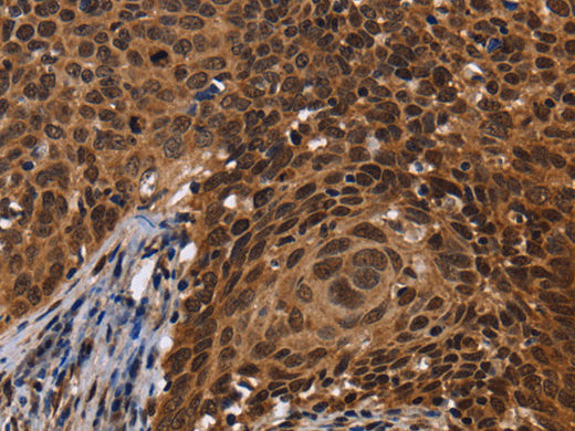 FASTKD5 Polyclonal Antibody Store at -20°C - MSE Supplies LLC