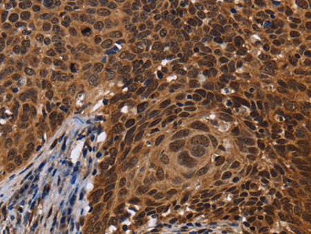 FASTKD5 Polyclonal Antibody Store at -20°C - MSE Supplies LLC