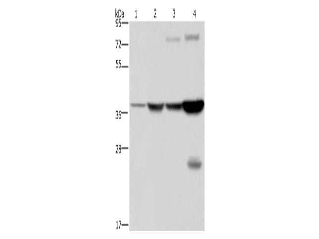 FBP1 Polyclonal Antibody Store at -20°C - MSE Supplies LLC