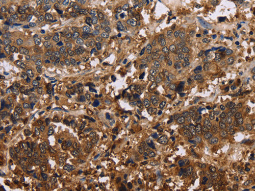 FBP2 Polyclonal Antibody Store at -20°C - MSE Supplies LLC